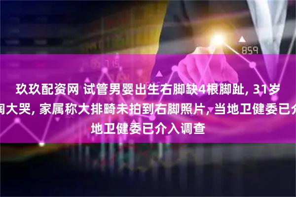 玖玖配资网 试管男婴出生右脚缺4根脚趾, 31岁产妇号啕大哭, 家属称大排畸未拍到右脚照片, 当地卫健委已介入调查